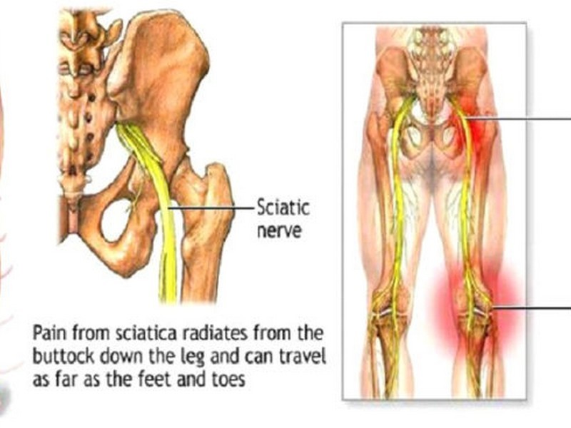 Neck And Shoulder Pain Relief Chiropractor Southport Near Me